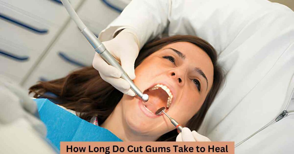 How Long Do Cut Gums Take to Heal